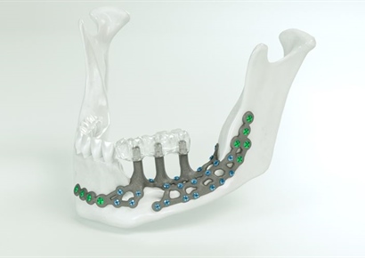 Coming Soon: More Support, Same Precision — IPS® Preprosthetic Evolved